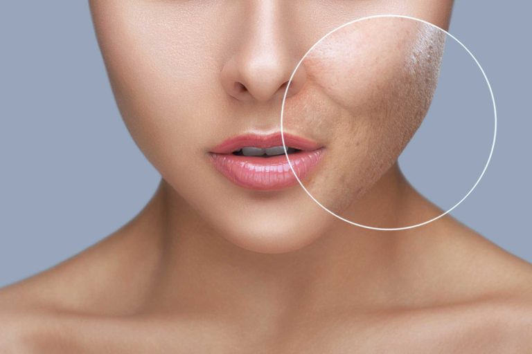 Showcasing the best co2 fractional laser machine for professional skin resurfacing and rejuvenation