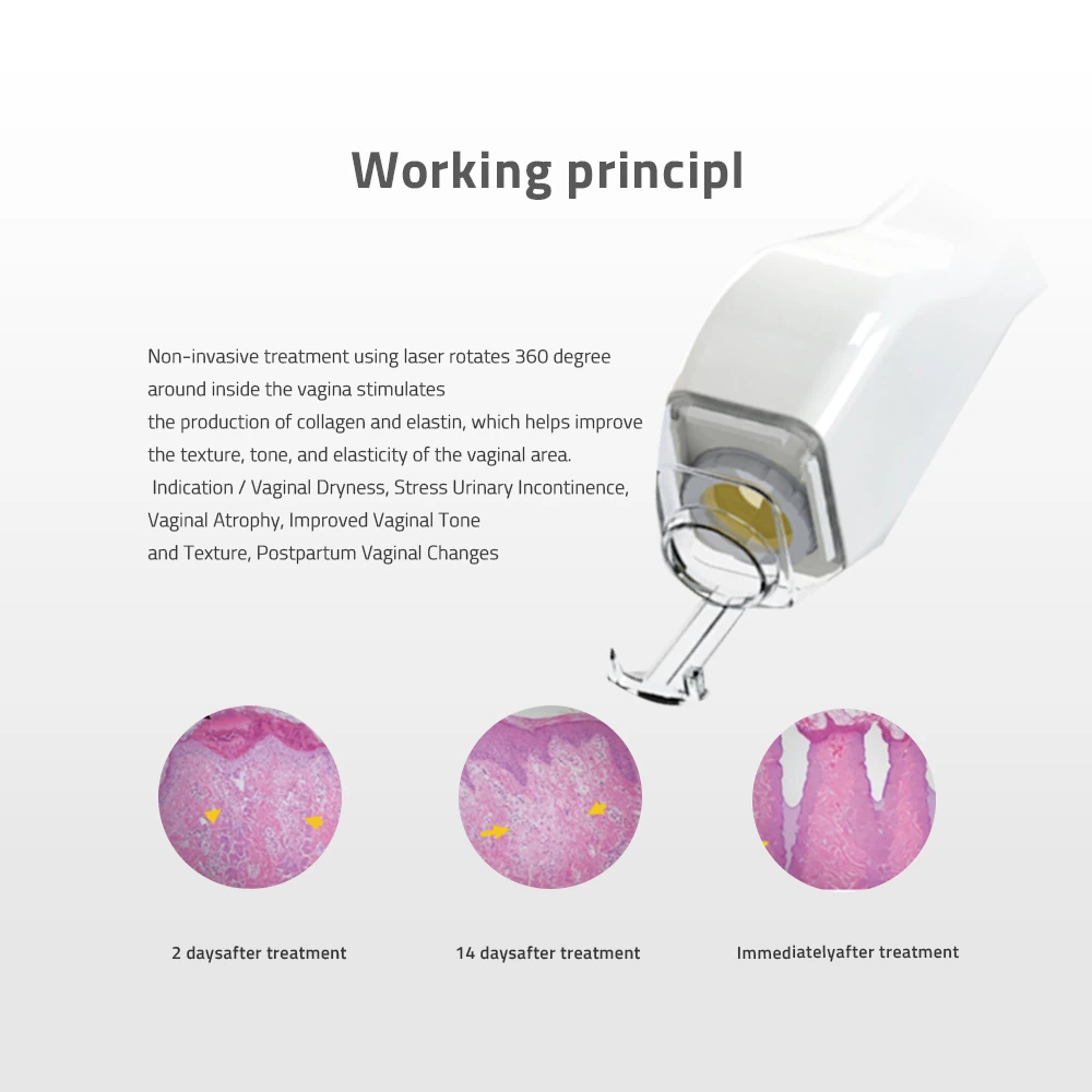 FONS-SVR 10600nm CO2 FRACTIONAL LASER MACHINE