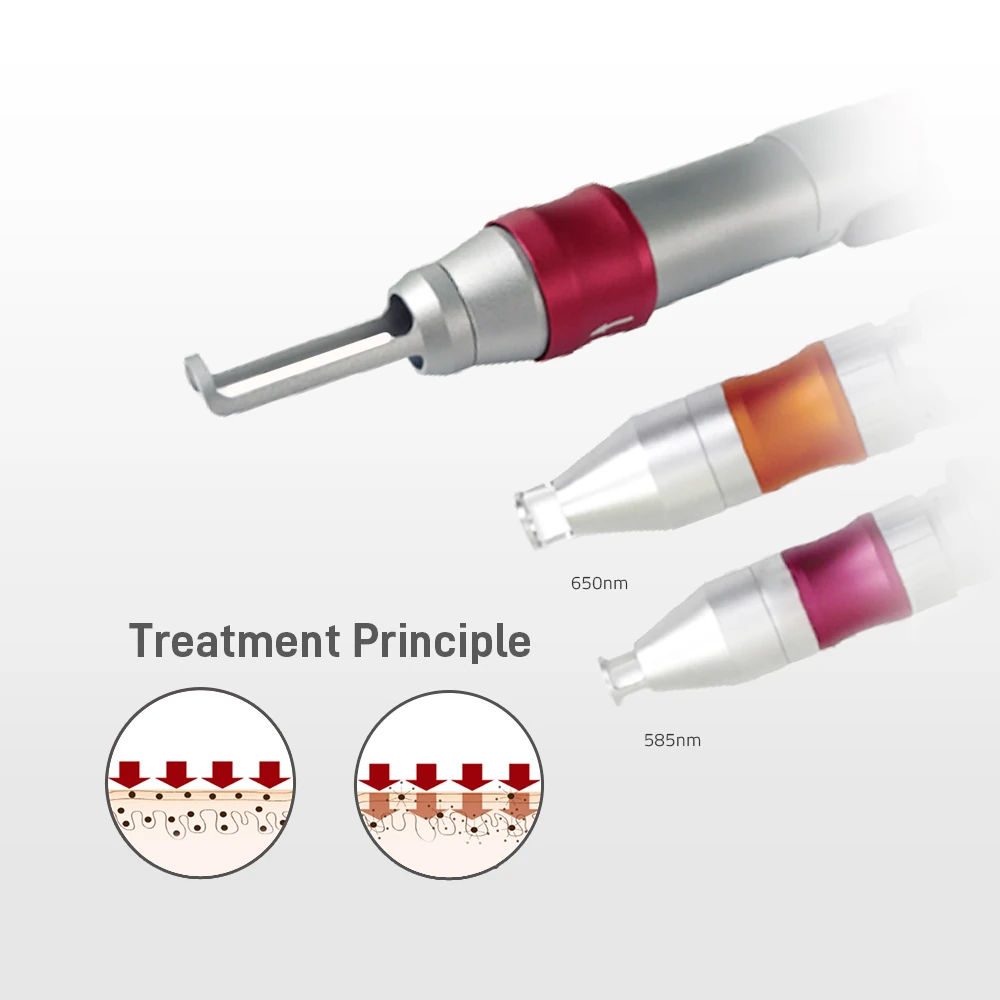 RE BEAN Q-SWITCHED ND:YAG LASER