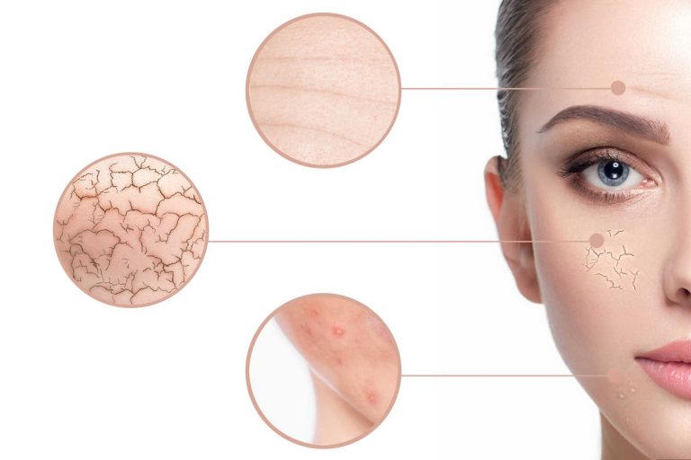 A professional fractional co2 laser treatment alternative using 1550nm and 1927nm dual-wavelengths for skin resurfacing